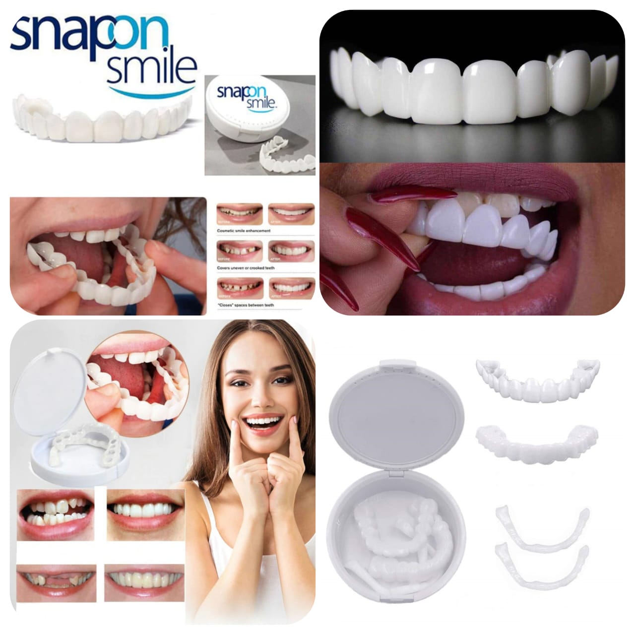 2 Pcs Tooth Cover (One Size Fits All)