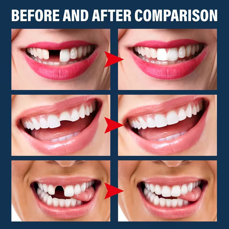 Moldable False Teeth