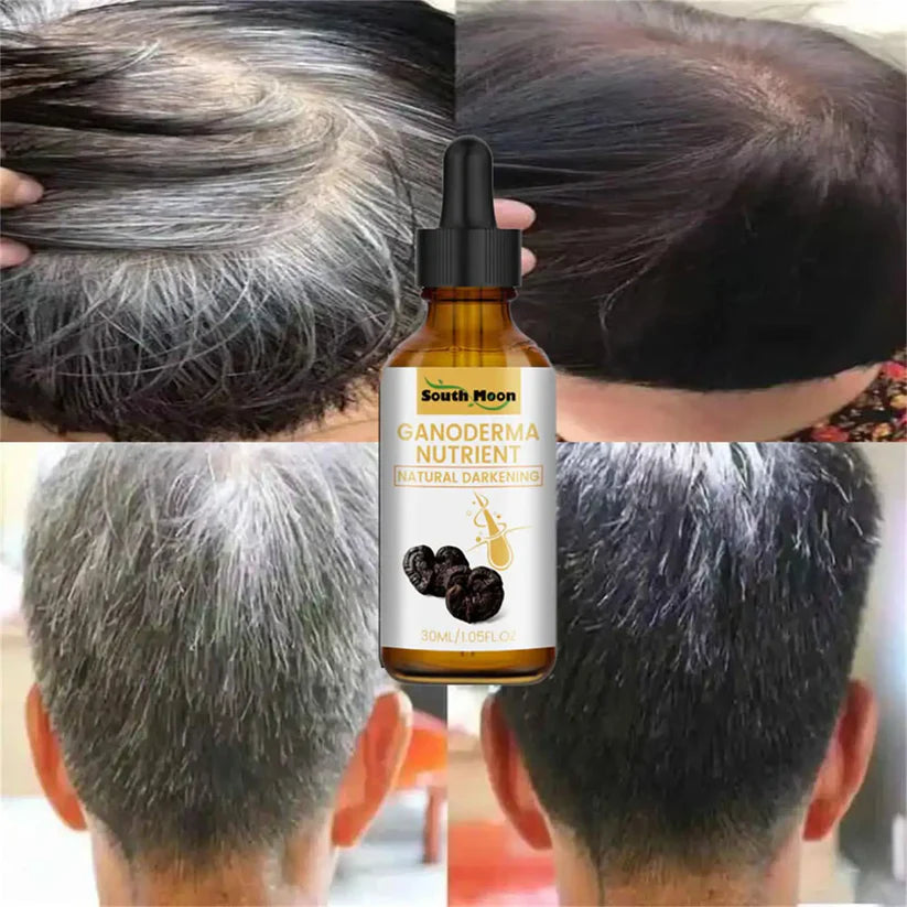 Unisex Hair Oil Serum (Guaranteed Result)