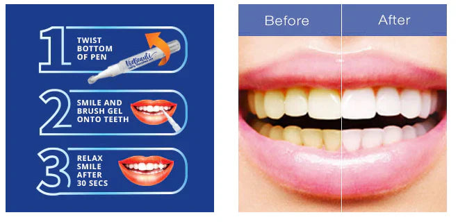 Dazzle Teeth Whitening Polish (Guaranteed Result)