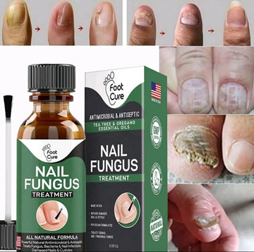 Nail Fungus Treatment Serum 10ml (Buy 1 Get 1 Free)