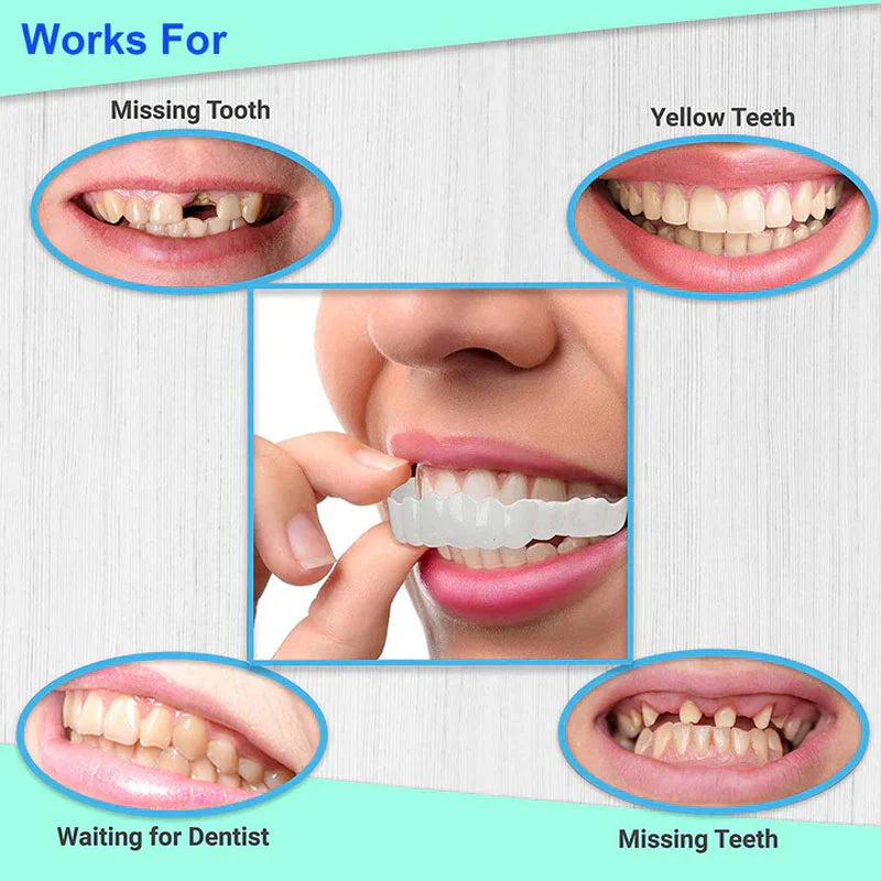 2 Pcs Tooth Cover (One Size Fits All)